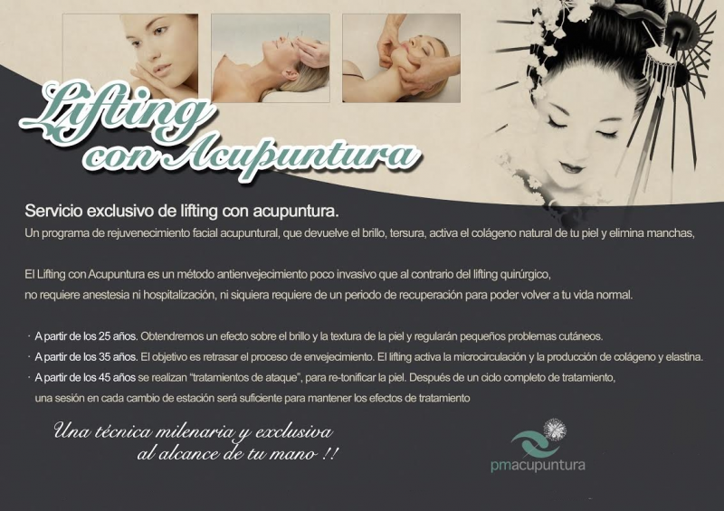 Acupuntura
