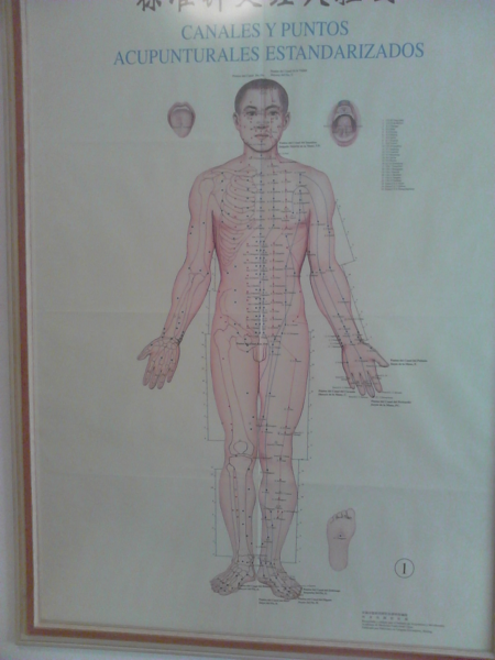 Acupuntura